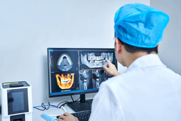 Best Emergency Tooth Extraction in Gaithersburg, MD